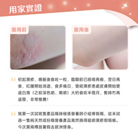 NatureU 顏 DAOMaster® 高分子VD+舒敏益生菌 抗組胺舒敏片 Hista Dissolve 30粒/瓶