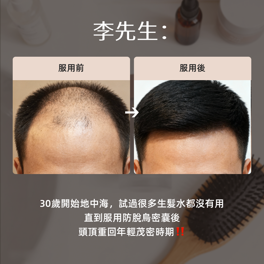 HairGlow_-_2_3dede8b7-4636-4d5c-8a2d-fca5a54b3d27.png
